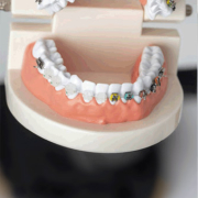 What is Cosmetic Dentistry? blog placeholder 3 e1693007859879