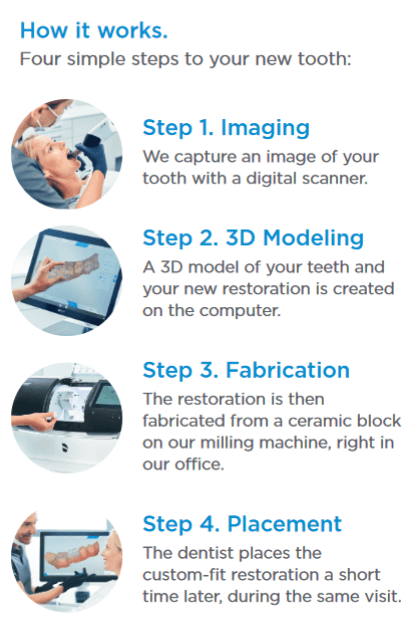 CEREC how it works